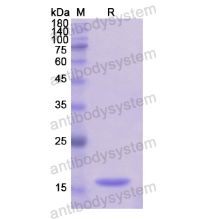 重组TSPAN9蛋白,Recombinant Human TSPAN9, N-His