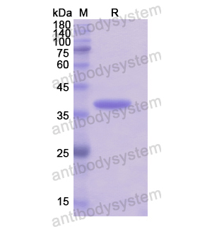 重組KRT33A蛋白,Recombinant Human KRT33A, N-His