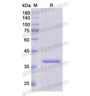 重組SNCG蛋白,Recombinant Human SNCG, N-GST