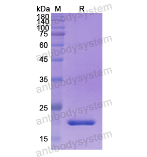 重組PDE5A蛋白,Recombinant Human PDE5A, N-His