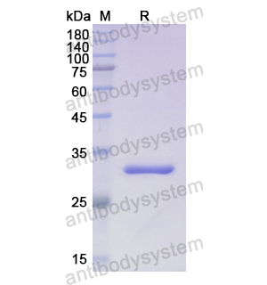 重组B3GAT3蛋白,Recombinant Human B3GAT3, N-His