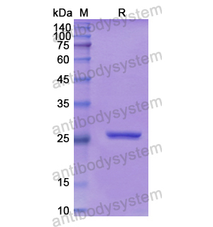 重組SLIT2蛋白,Recombinant Human SLIT2, N-His