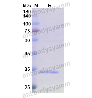 重組TOMM70蛋白,Recombinant Human TOMM70, N-His