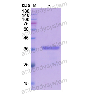 重組CDK14蛋白,Recombinant Human CDK14, N-His