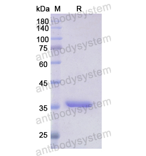 重組GLS蛋白,Recombinant Human GLS, N-His