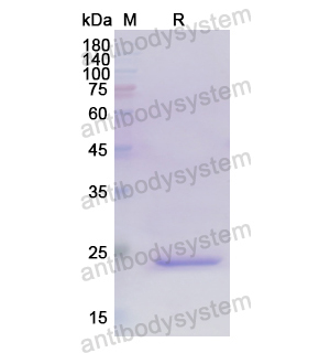 重組TNFSF15蛋白,Recombinant Human TNFSF15, N-His