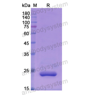 重組LYPLA2蛋白,Recombinant Human LYPLA2, N-His