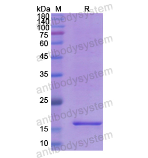 重组SVIL蛋白,Recombinant Human SVIL, N-His