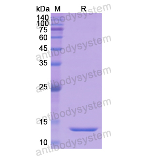 重組SLC34A2/NaPi2b蛋白,Recombinant Human SLC34A2/NaPi2b, N-His