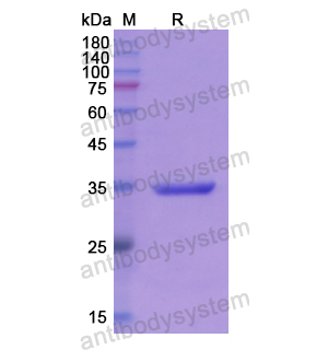 重組PARN蛋白,Recombinant Human PARN, N-GST