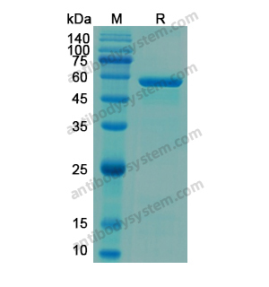 重組H6PD蛋白,Recombinant Human H6PD, N-His