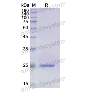 重組VNN1蛋白,Recombinant Human VNN1, N-His