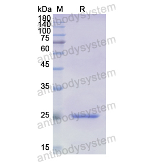 重组ADCY5蛋白,Recombinant Human ADCY5, N-His