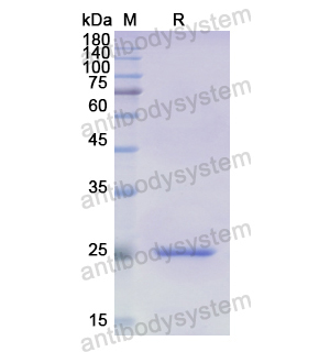 重組ADCY5蛋白,Recombinant Human ADCY5, N-His