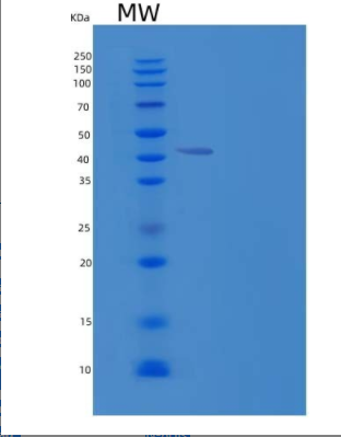 Recombinant Human OBFC1/CST Complex Subunit STN1 Protein(N-6His),Recombinant Human OBFC1/CST Complex Subunit STN1 Protein(N-6His)