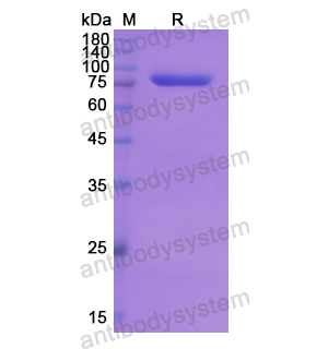 重組BRD1蛋白,Recombinant Human BRD1, N-GST