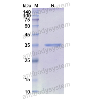 重組CXCL14/BRAK/MIP-2G蛋白,Recombinant Human CXCL14/BRAK/MIP-2G, N-GST