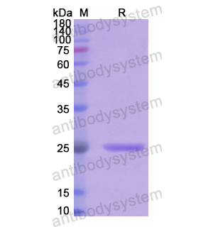 重組FGF19蛋白,Recombinant Human FGF19, N-His