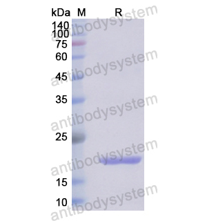 重组IL33蛋白,Recombinant Human IL33, N-His