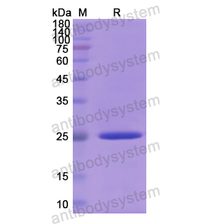 重组DDX58蛋白,Recombinant Human DDX58, N-His