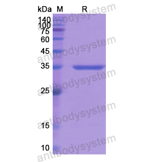 重組BAG3蛋白,Recombinant Human BAG3, N-GST