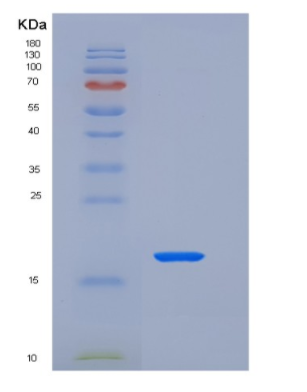 Recombinant Human Parathyroid Hormone-Related Protein/PTHLH Protein(C-6His),Recombinant Human Parathyroid Hormone-Related Protein/PTHLH Protein(C-6His)