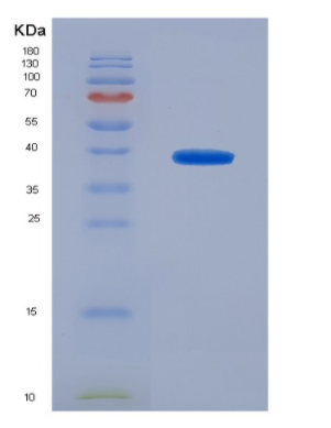 Eukaryotic Triggering Receptor Expressed On Myeloid Cells 1 (TREM1),Eukaryotic Triggering Receptor Expressed On Myeloid Cells 1 (TREM1)