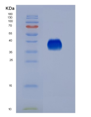 Eukaryotic Interleukin 9 (IL9),Eukaryotic Interleukin 9 (IL9)