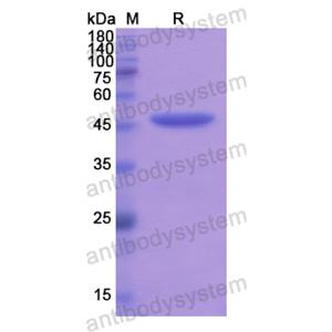 Recombinant Human SOAT2, N-His