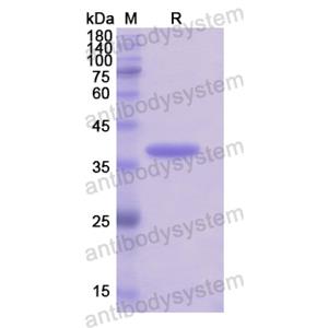 重組KRT33A蛋白,Recombinant Human KRT33A, N-His