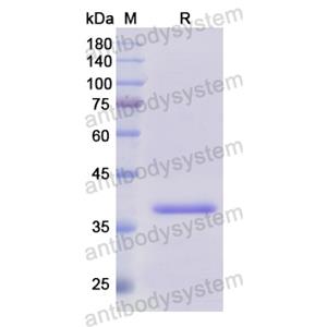 重組SNCG蛋白,Recombinant Human SNCG, N-GST