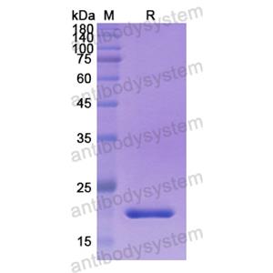 Recombinant Human PDE5A, N-His