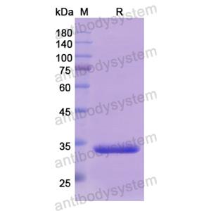 Recombinant Human DDAH1, N-His