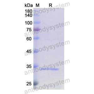重組TOMM70蛋白,Recombinant Human TOMM70, N-His
