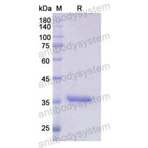 重組GLS蛋白,Recombinant Human GLS, N-His