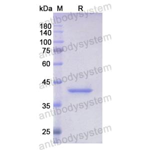 重組CCNB2蛋白,Recombinant Human CCNB2, N-His