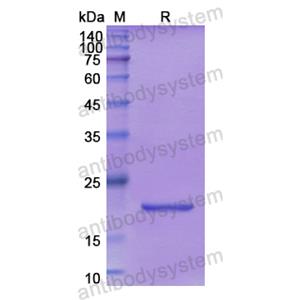 Recombinant Human SCEL, N-His