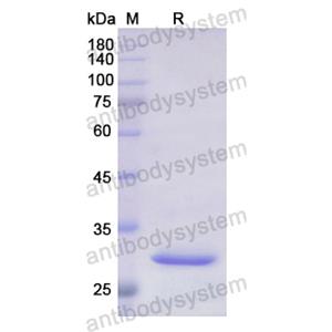 Recombinant Human ABCB11, N-His