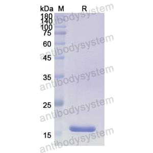 重组CCN4蛋白,Recombinant Human CCN4, N-His