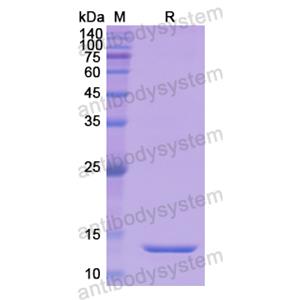 重組SLC34A2/NaPi2b蛋白,Recombinant Human SLC34A2/NaPi2b, N-His