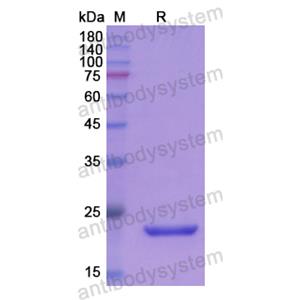 Recombinant Human APOM, N-His