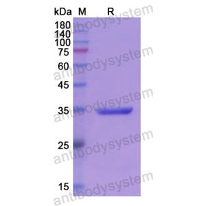 Recombinant Human PARN, N-GST