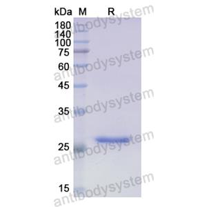 Recombinant Human ABCA1, N-His