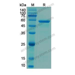 Recombinant Human H6PD, N-His