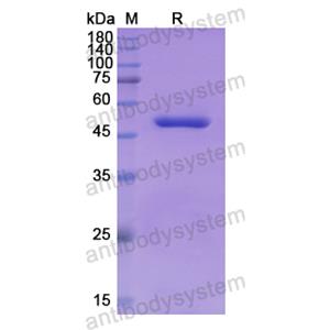 重組NADK蛋白,Recombinant Human NADK, N-GST