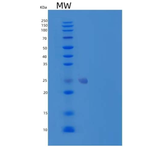Recombinant Human High Mobility Group Protein B2/HMGB2 Protein(C-6His)