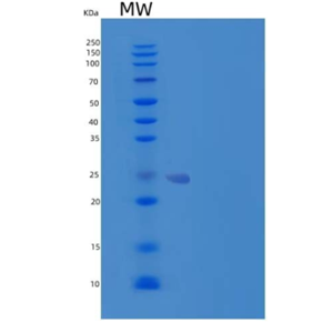 Recombinant Human Hippocalcin-Like Protein 1/HPCAL1 Protein(N-6His)