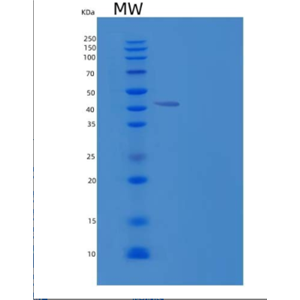 Recombinant Human OBFC1/CST Complex Subunit STN1 Protein(N-6His)