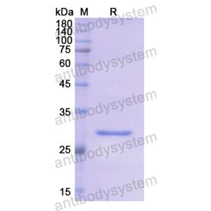 Recombinant Human STAMBP, N-His