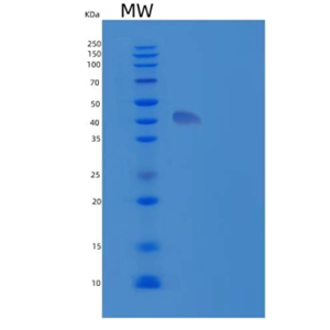Recombinant Human IA2/PTPRN Protein(Arg576-Gln950, N-6His)